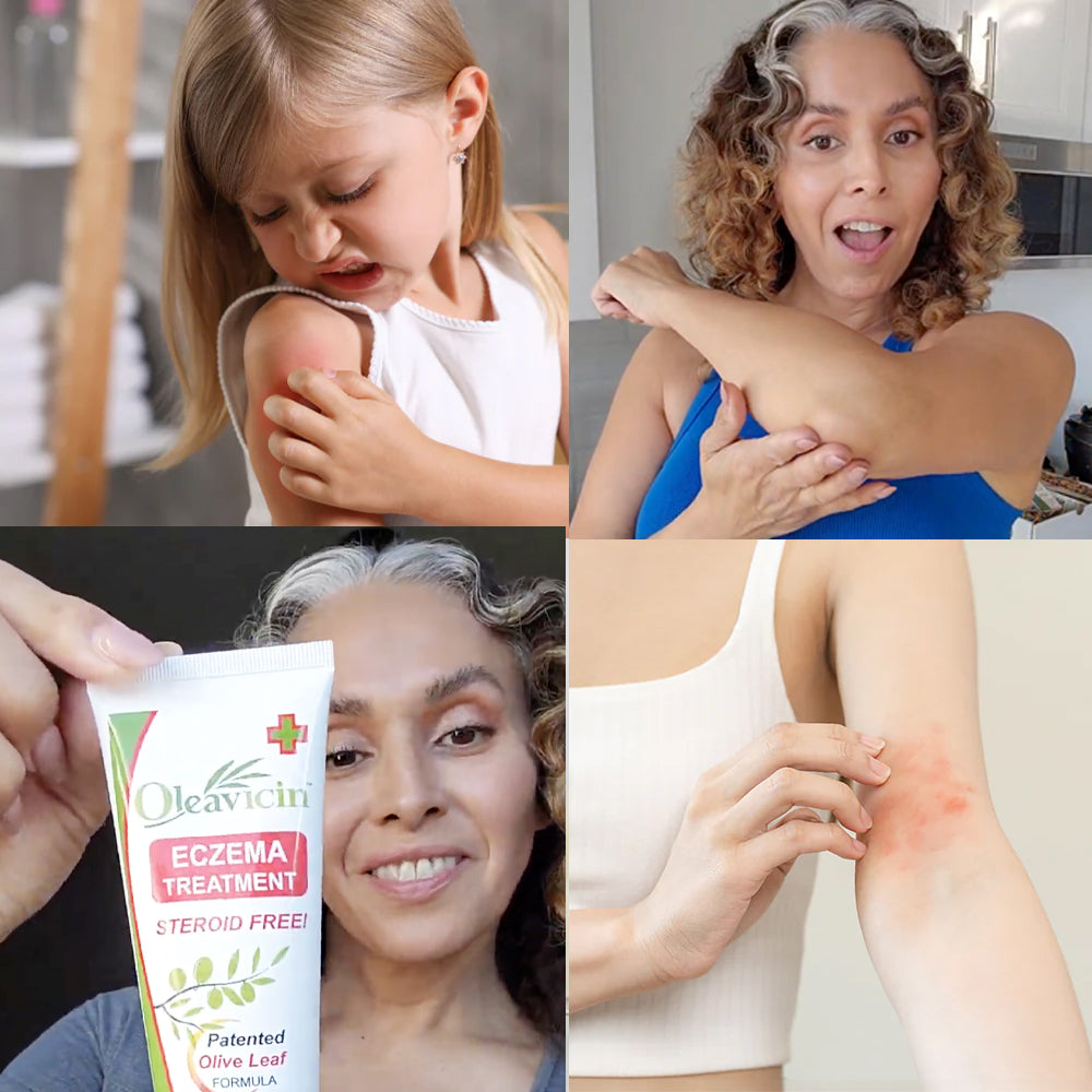 Natural Eczema Relief That Parents Trust & Kids Love